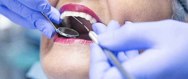 Best Knocked-Out Tooth (Avulsed Tooth) Treatment in Hazard, KY